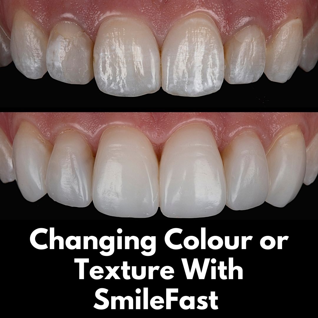 SmileFast | Cherrybank Dental Spa Edinburgh