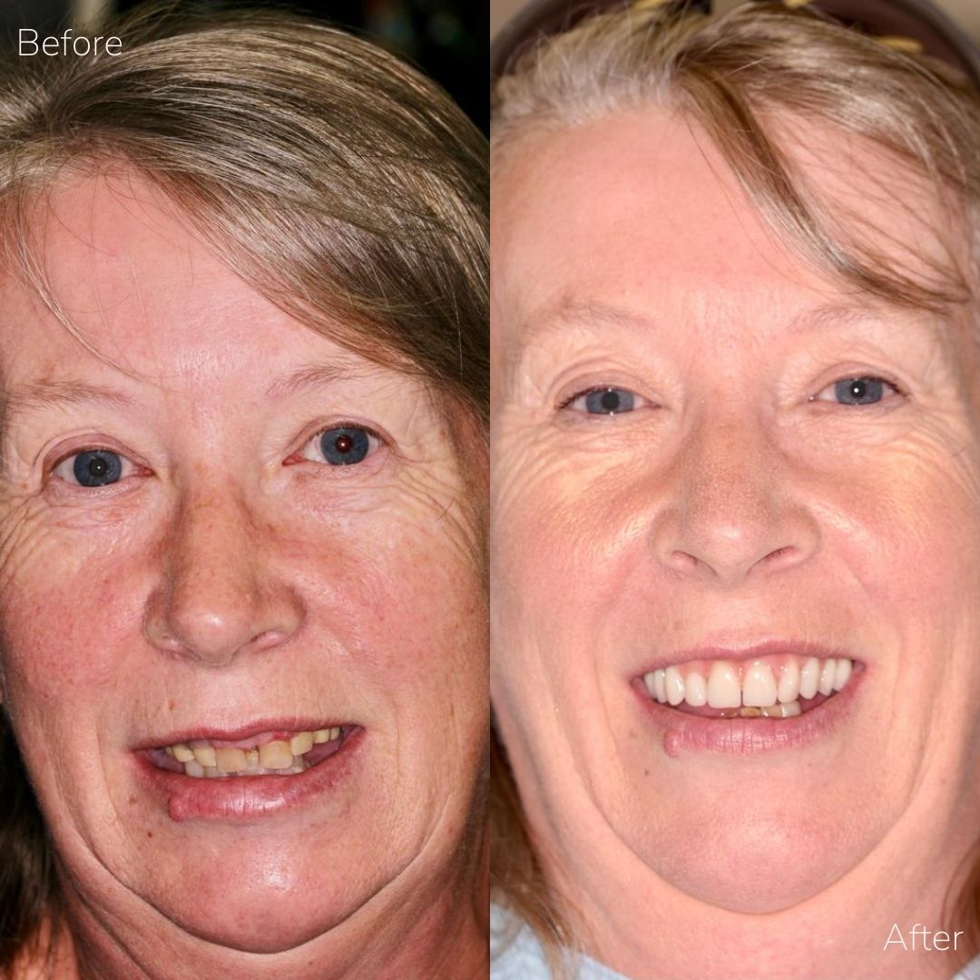 Before and after treatment at Cherrybank Dental Spa in Edinburgh 