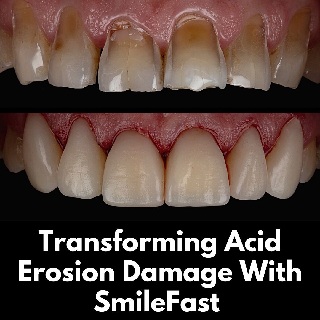SmileFast | Cherrybank Dental Spa Edinburgh