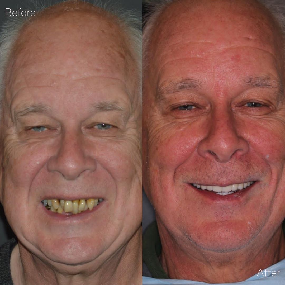 Before and after treatment at Cherrybank Dental Spa in Edinburgh 