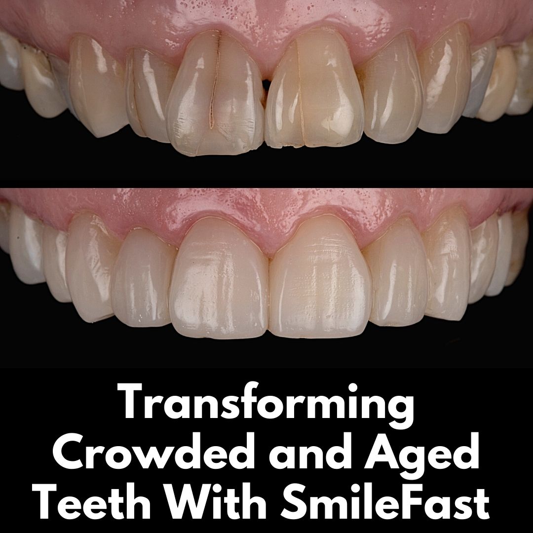 SmileFast | Cherrybank Dental Spa Edinburgh