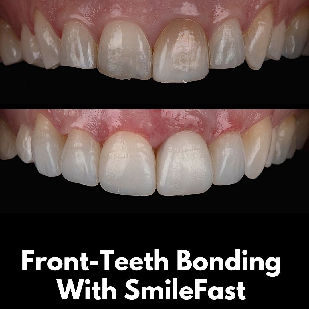 SmileFast | Cherrybank Dental Spa Edinburgh