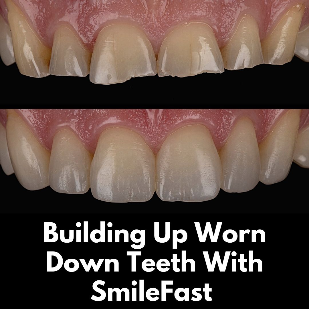 SmileFast | Cherrybank Dental Spa Edinburgh