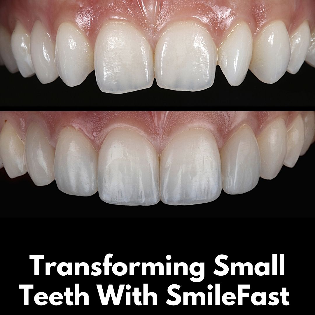 SmileFast | Cherrybank Dental Spa Edinburgh