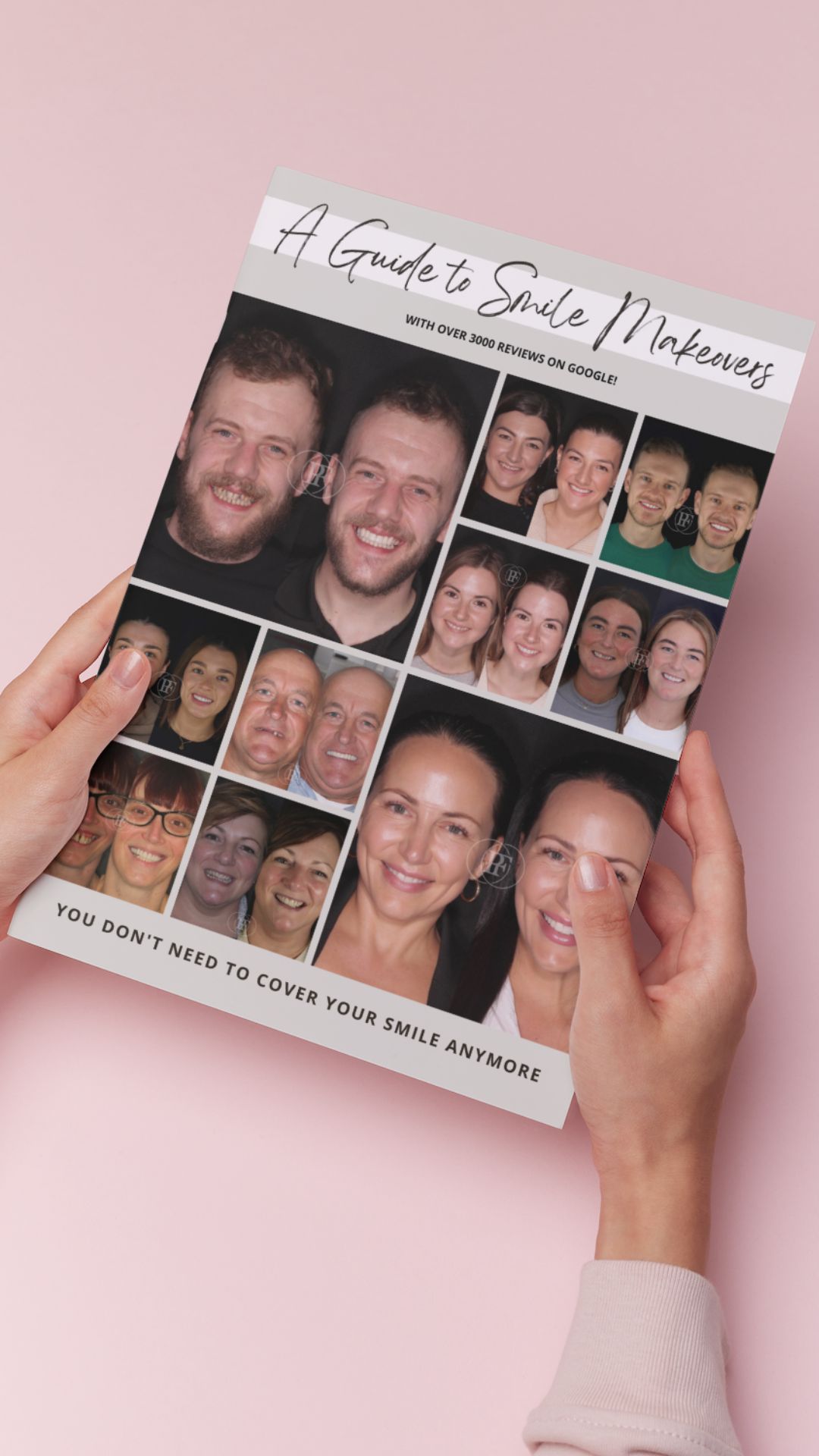 Smile Makeovers in Edinburgh | Cherrybank Dental Spa Edinburgh Download our Smile Makeover Guide