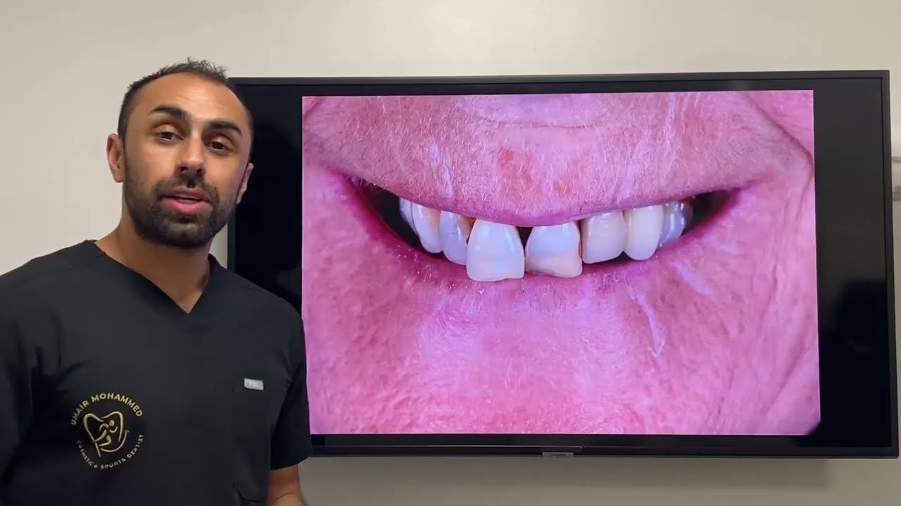 Dental Implants in Edinburgh