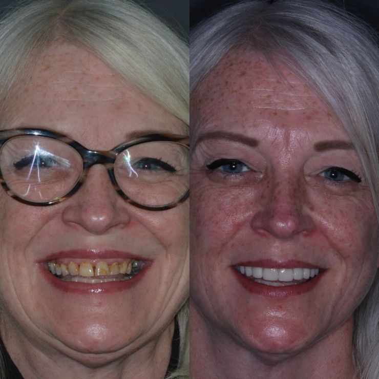Transforming Smiles in Edinburgh 