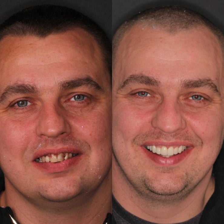 Transforming Smiles in Edinburgh 