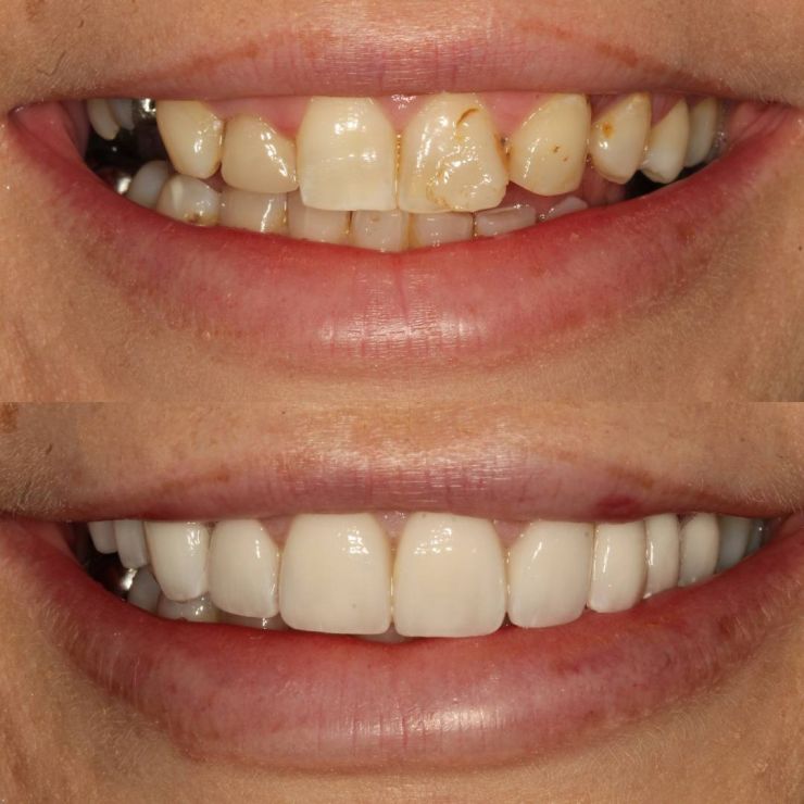 Transforming Smiles in Edinburgh 