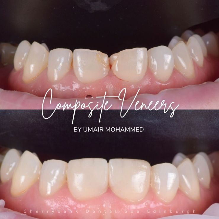 Smile Gallery | Cherrybank Dental Spa Edinburgh