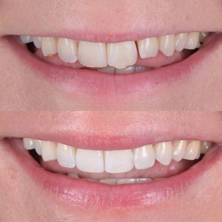 Transforming Smiles in Edinburgh 