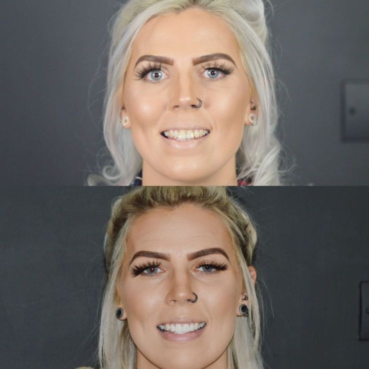 Transforming Smiles in Edinburgh 