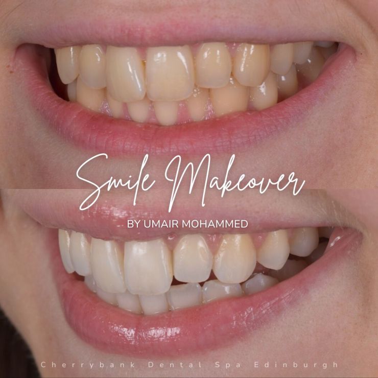 Smile Gallery | Cherrybank Dental Spa Edinburgh