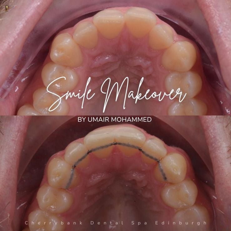 Smile Gallery | Cherrybank Dental Spa Edinburgh