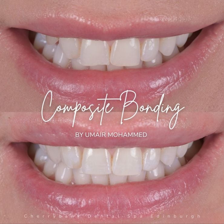 Smile Gallery | Cherrybank Dental Spa Edinburgh
