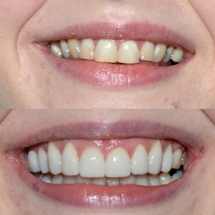 Transforming Smiles in Edinburgh 