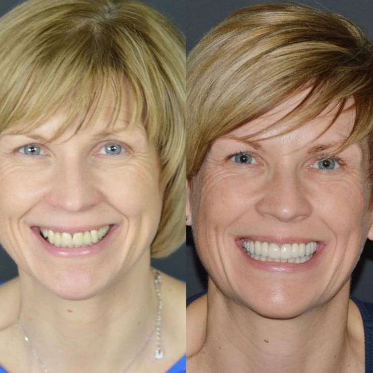 Transforming Smiles in Edinburgh 