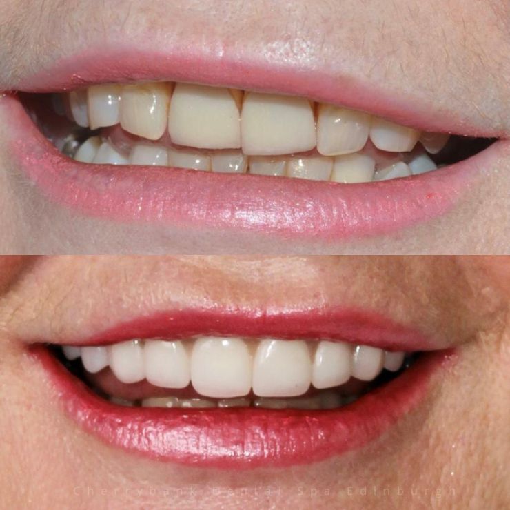 Transforming Smiles in Edinburgh 