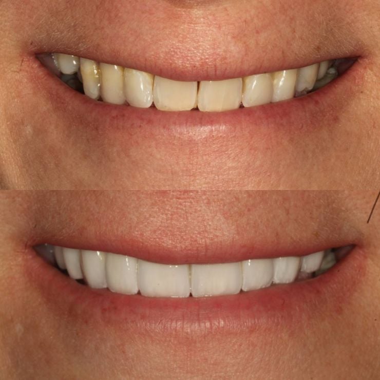 Transforming Smiles in Edinburgh 