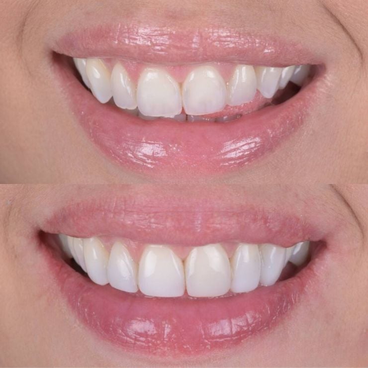 Transforming Smiles in Edinburgh 