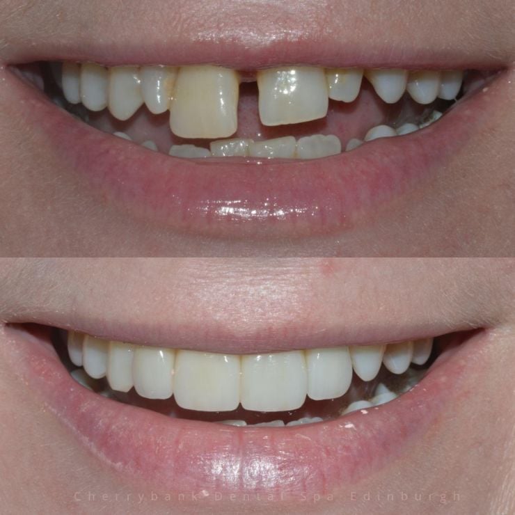 Transforming Smiles in Edinburgh 