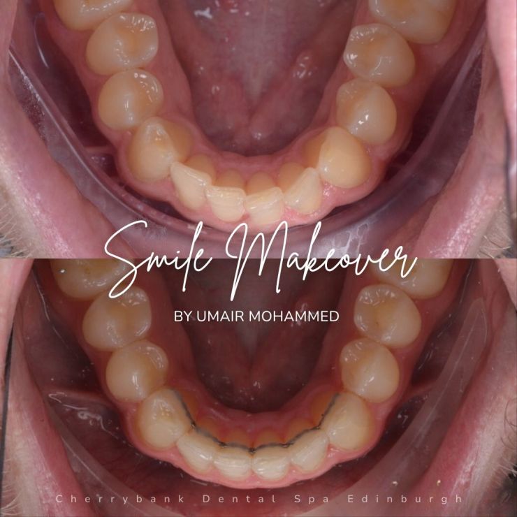 Smile Gallery | Cherrybank Dental Spa Edinburgh