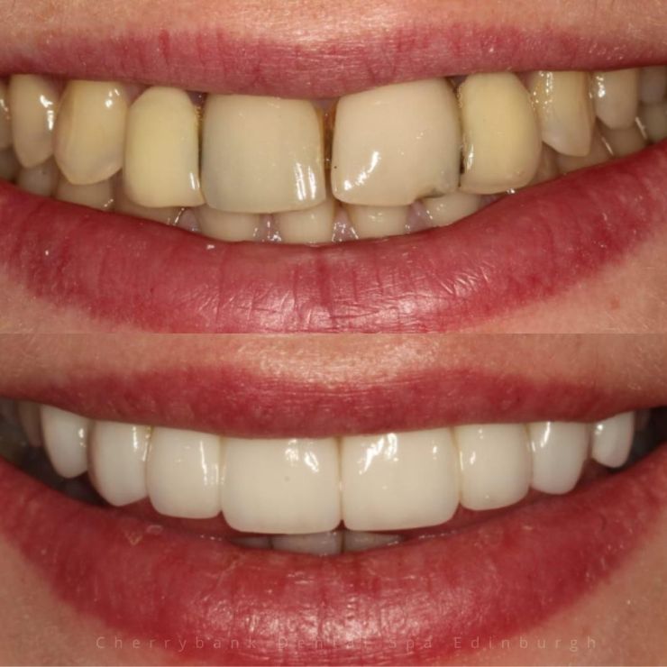 Transforming Smiles in Edinburgh 