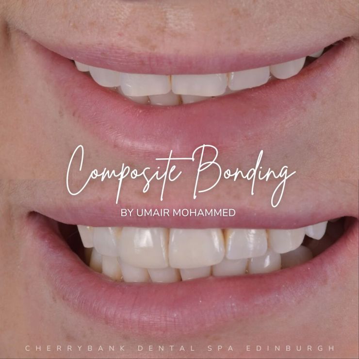 Smile Gallery | Cherrybank Dental Spa Edinburgh