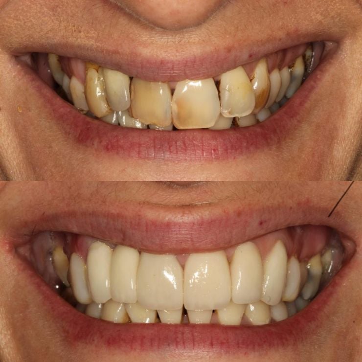 Transforming Smiles in Edinburgh 