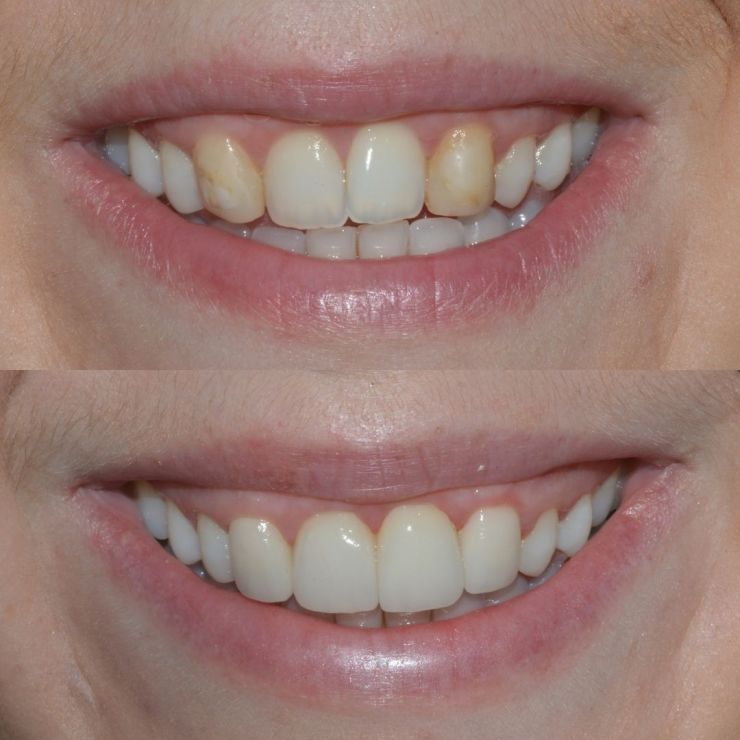Transforming Smiles in Edinburgh 