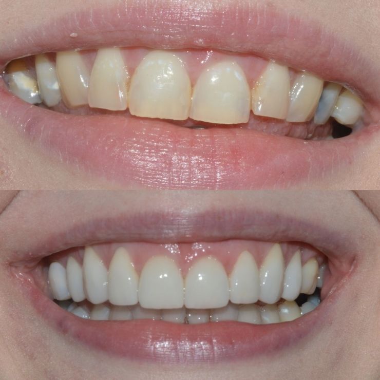 Transforming Smiles in Edinburgh 