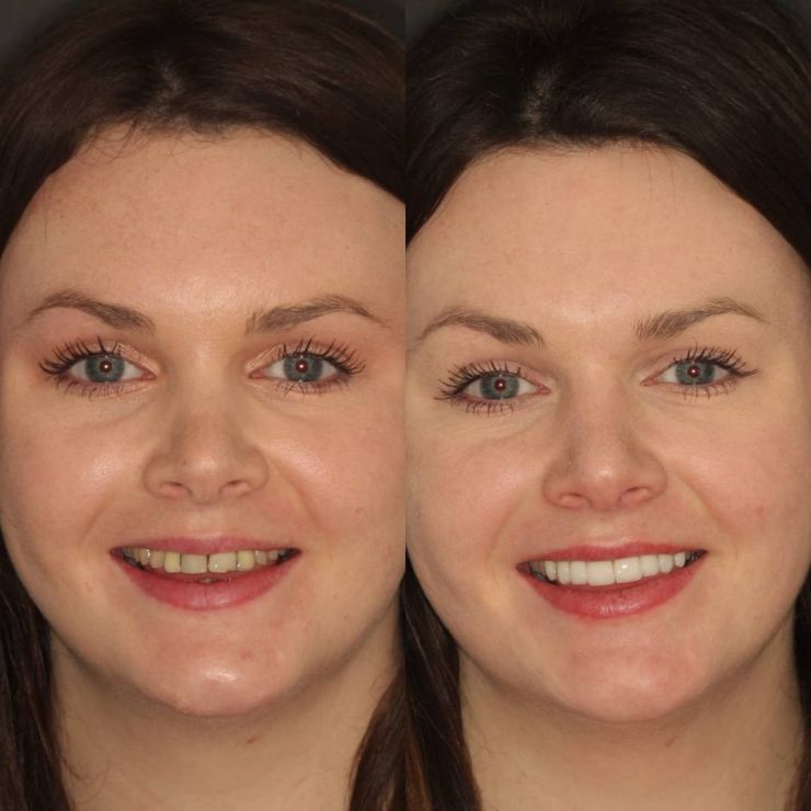 Transforming Smiles in Edinburgh 
