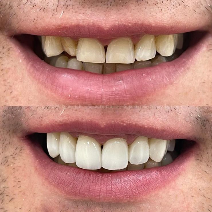 Transforming Smiles in Edinburgh 
