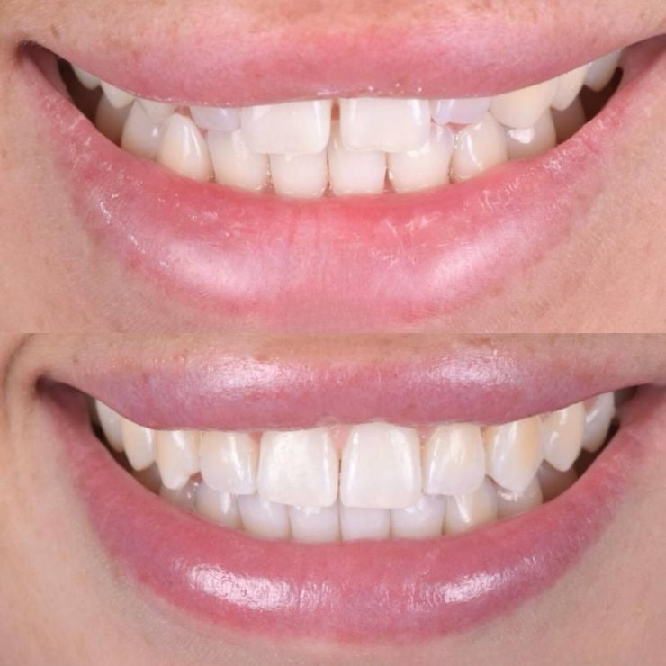 Transforming Smiles in Edinburgh 
