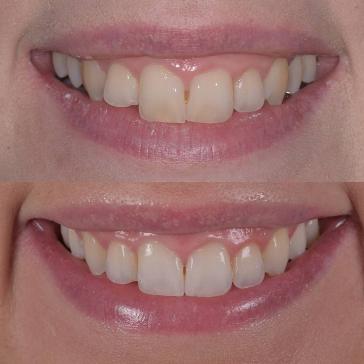 Transforming Smiles in Edinburgh 