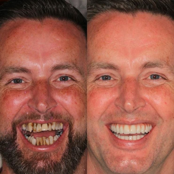 Transforming Smiles in Edinburgh 