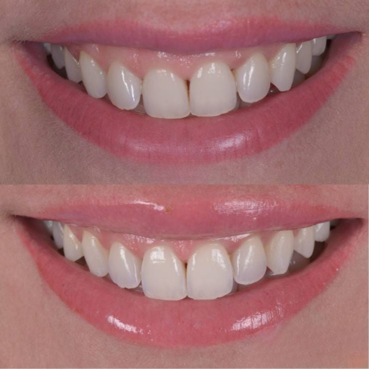 Transforming Smiles in Edinburgh 