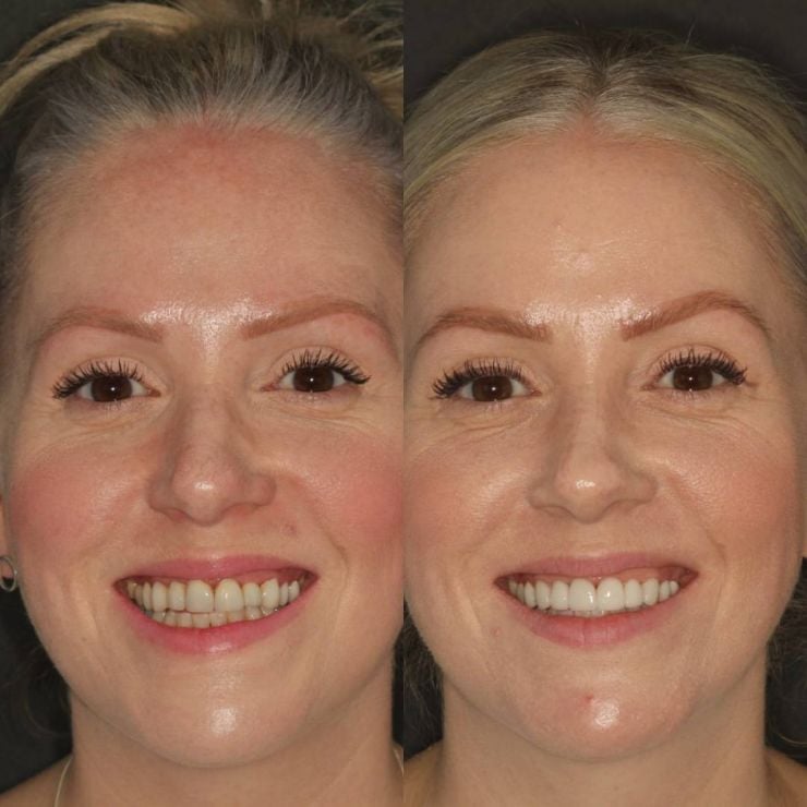 Transforming Smiles in Edinburgh 