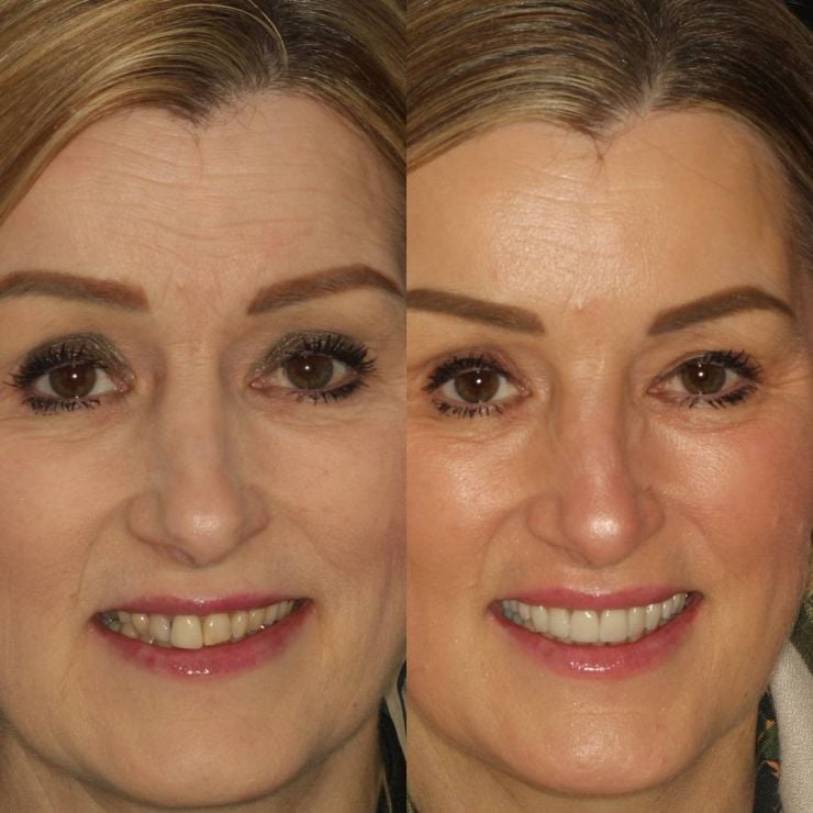 Transforming Smiles in Edinburgh 