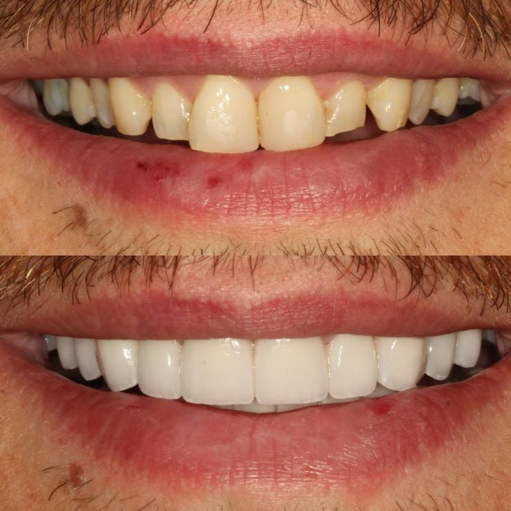 Transforming Smiles in Edinburgh 