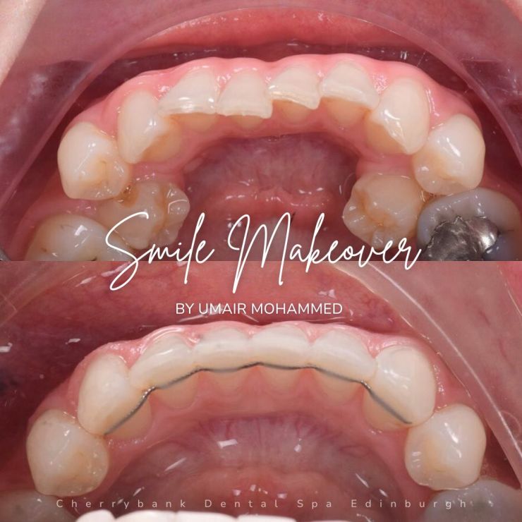 Smile Gallery | Cherrybank Dental Spa Edinburgh