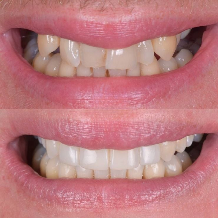Transforming Smiles in Edinburgh 