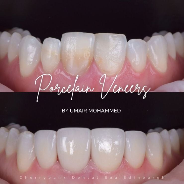 Smile Gallery | Cherrybank Dental Spa Edinburgh