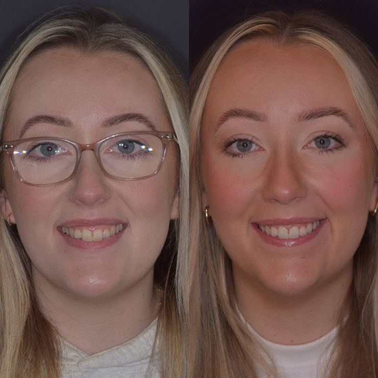 Transforming Smiles in Edinburgh 