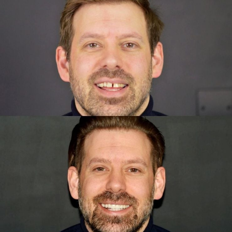 Transforming Smiles in Edinburgh 