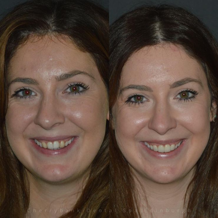 Transforming Smiles in Edinburgh 