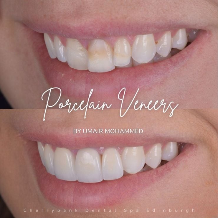 Smile Gallery | Cherrybank Dental Spa Edinburgh