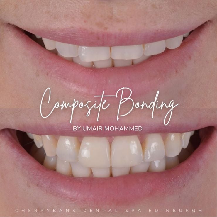 Smile Gallery | Cherrybank Dental Spa Edinburgh