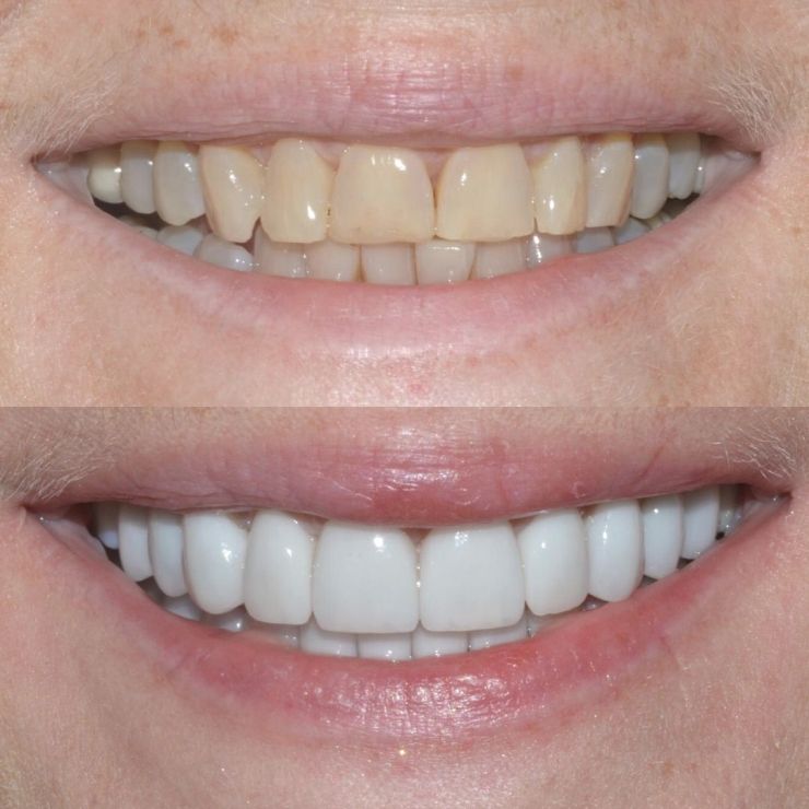 Transforming Smiles in Edinburgh 