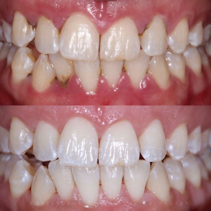 Transforming Smiles in Edinburgh 